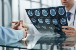 How Do I Find a Brain Injury Lawyer?