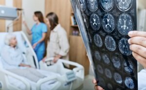 What is My TBI Case Worth